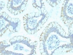 Smad4 Antibody (SPM448) - Azide and BSA Free, Novus Biologicals 100 &mu;g;